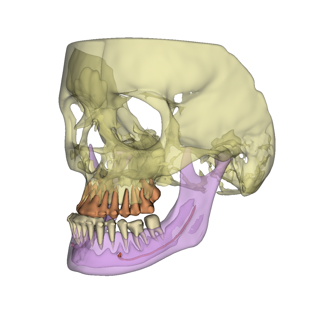 Fully automatic segmentation of anatomical structures in CBCT and multi-slice CT scans.